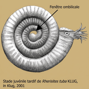 Fenêtre ombilicale